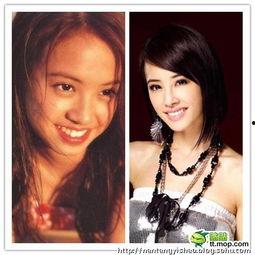 爆料女星削骨视频,女星削骨手术全过程，惊悚视频曝光